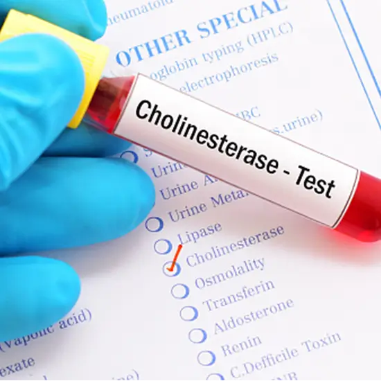 Cholinesterase Serum Test